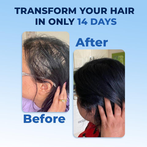 FEG Plus Hair Growth Serum